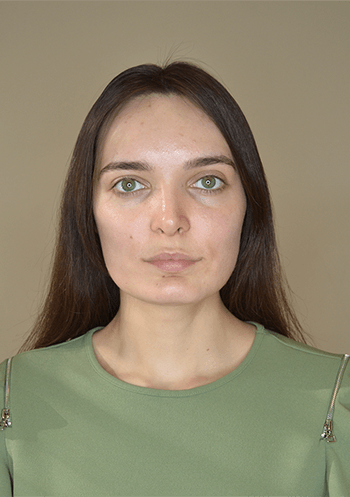 Фото «ДО»